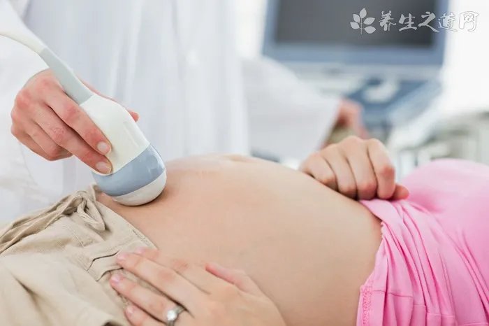 中年女性巧养生