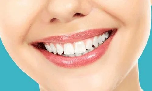 一般洗牙一次多少钱