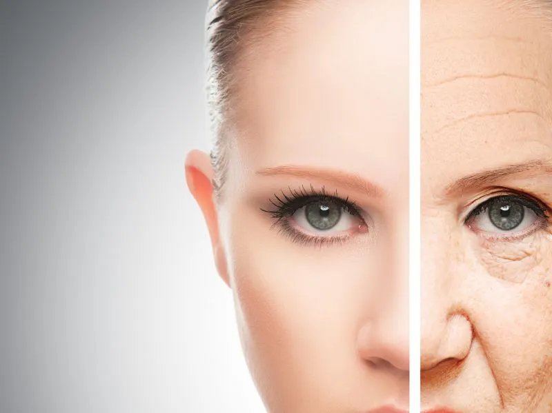 玻尿酸去除鱼尾纹的效果