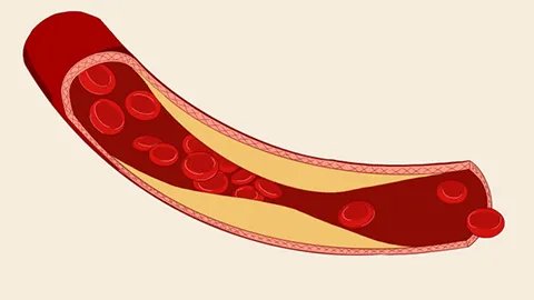 红细胞变异系数偏低什么意思