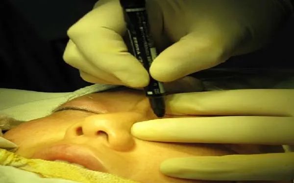 北京好的眼部手术整形医院在哪？