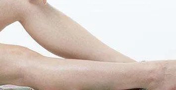 瘦小腿手术坏处