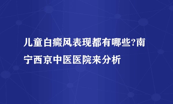 儿童白癜风表现都有哪些?南宁西京中医医院来分析