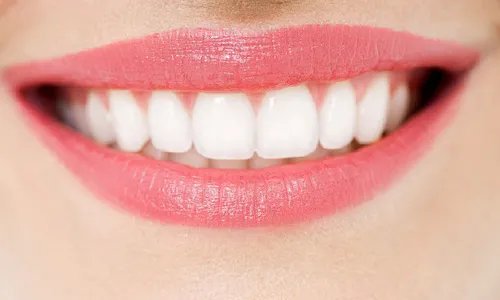 一般洗牙一次多少钱