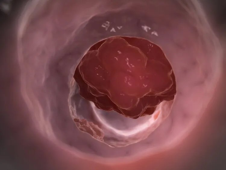 抗癌利器来了！精准“射杀”癌细胞，身体损害小