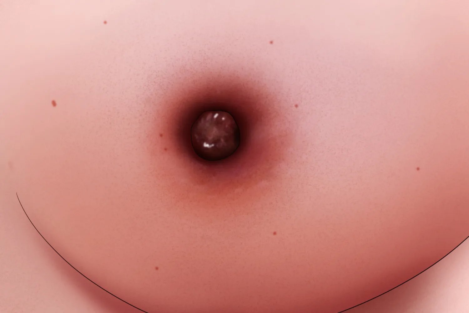 五张图认识乳腺癌早期