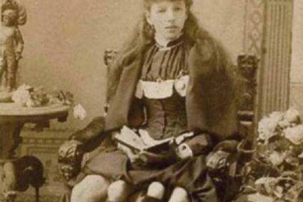 世界上腿最多的女人:拥有4条腿(生下一个健康的女儿)