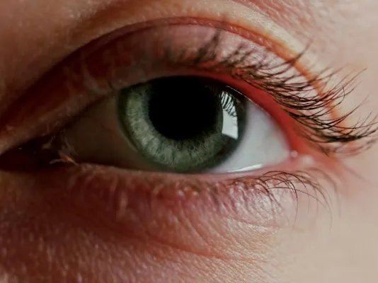 眼部美容祛皱纹的方法