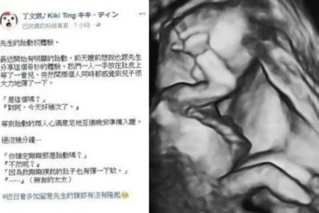 林宥嘉胎动初体验 与网友分享奇妙感受