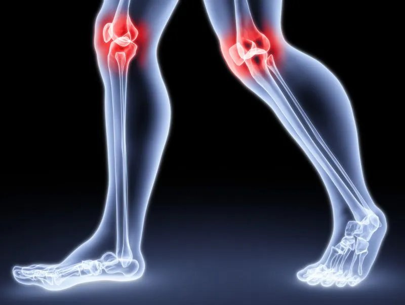 小腿骨裂的症状