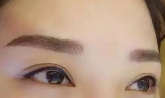 北京双眼皮去哪家医院好？