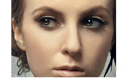 玻尿酸隆鼻前后对比