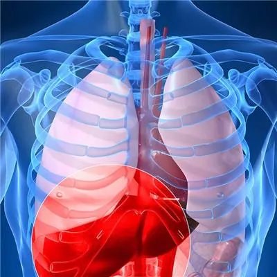 治疗丙肝去哪里