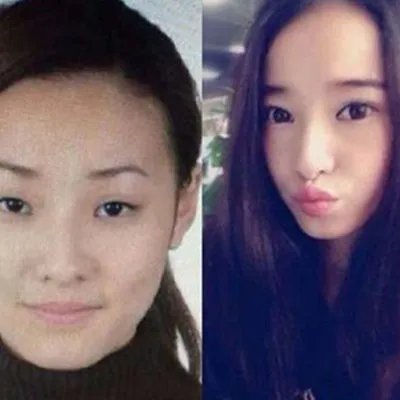 欧弟女友整容对比照片曝光 其挺身护娇妻：完全没有整容