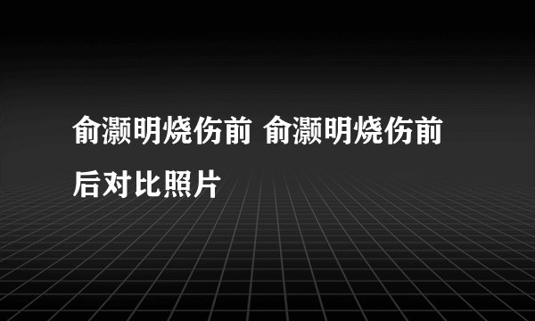 俞灏明烧伤前 俞灏明烧伤前后对比照片