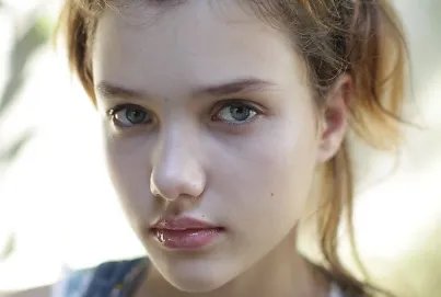 激光痤疮治疗要多少钱