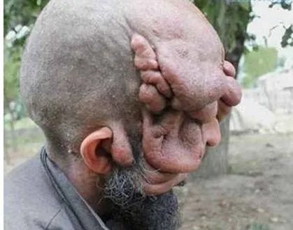 世界上长得最丑的男人图片 乌干达最丑男子丑出新高度而走红