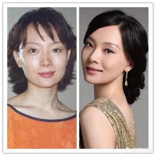 哪些女明星整过容？