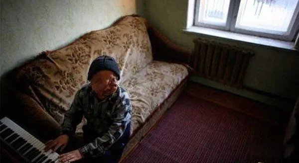 辐射幽灵婴儿是什么意思 日本核电站福岛变异人照片曝光