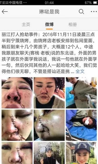 丽江被打毁容女子再发声：我真的没有骂过丽江是怎么回事？