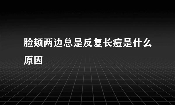 脸颊两边总是反复长痘是什么原因