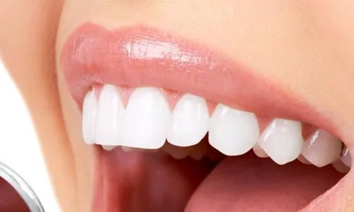 一般洗牙一次多少钱