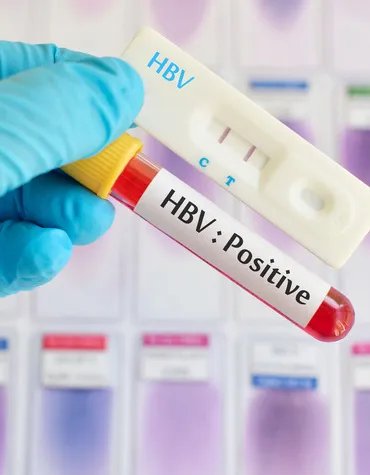 “娇韵诗纤体精华”网友亲身使用小记