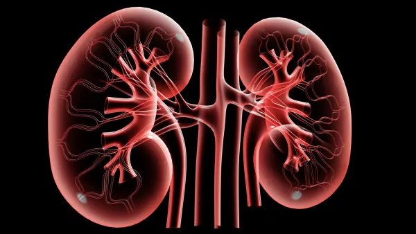 肾结石自然疗法有哪些