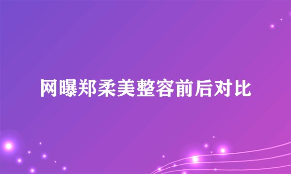 网曝郑柔美整容前后对比