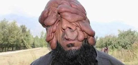 世界上长得最丑的男人图片 乌干达最丑男子丑出新高度而走红