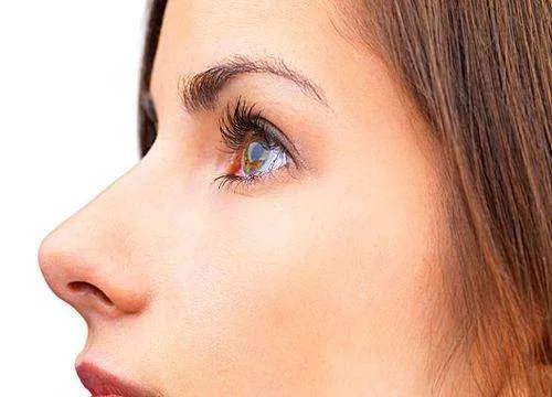 破尿酸注射隆鼻的价格