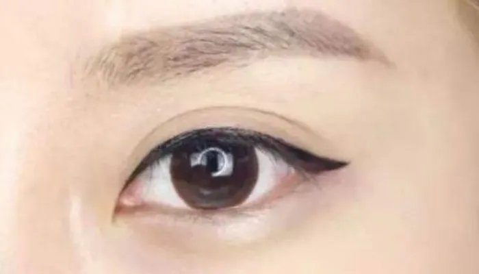 激光洗眼线好处与坏处