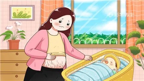 妊娠纹什么时候开始长