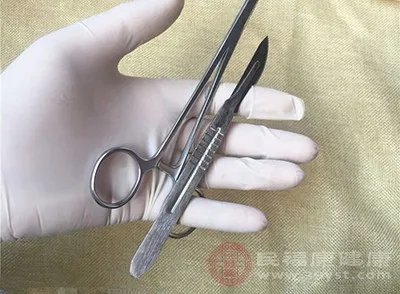 韩式无痕阴道紧缩术注意事项