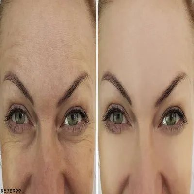 喝什么粥美白养颜祛斑