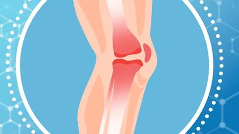 脚踝韧带拉伤的症状