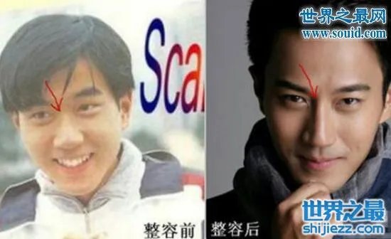 刘恺威整容前后照片曝光，五官全整简直大换脸 
