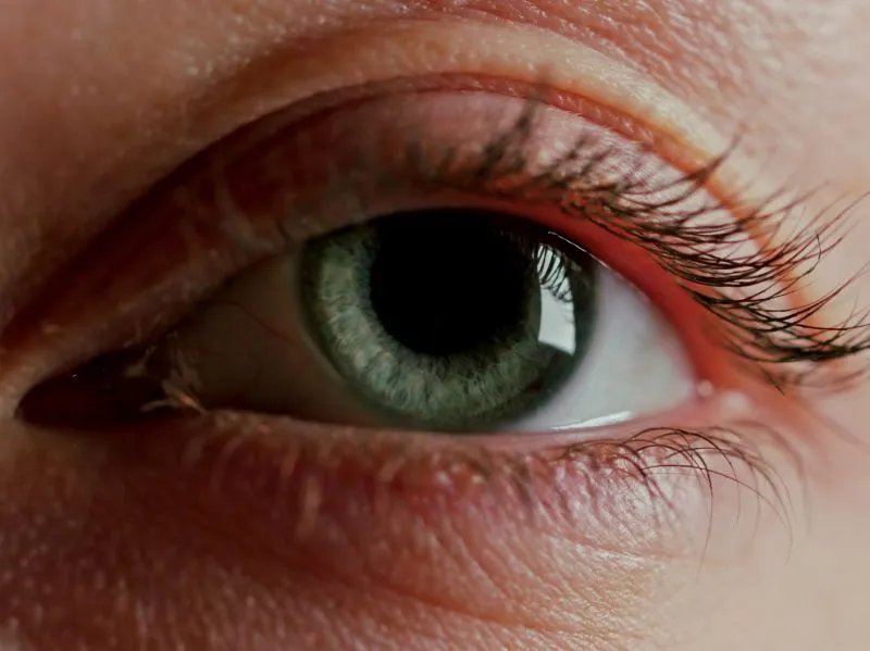 吸脂除去眼袋的注意事项