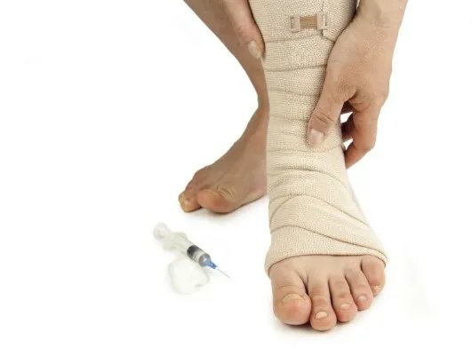 四肢无力肌肉酸痛的原因及治疗