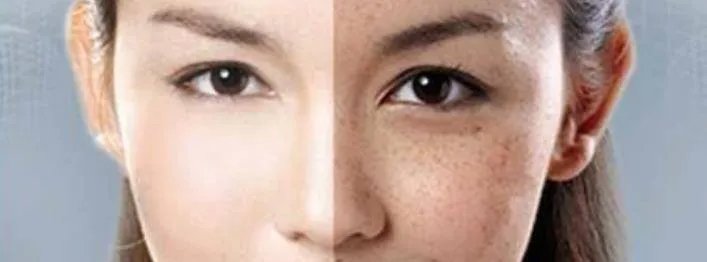 柿子叶加白凡士林真的能祛斑吗