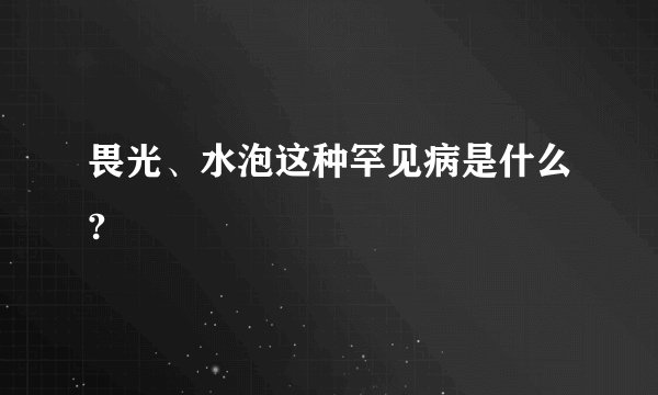 畏光、水泡这种罕见病是什么?