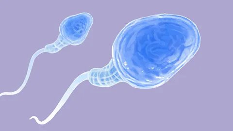 男性精子检查标准