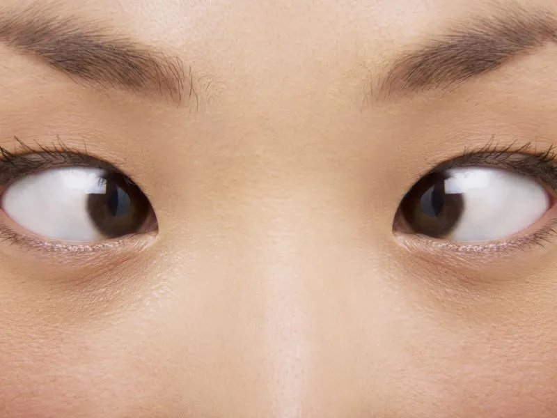 鸡眼是什么颜色的