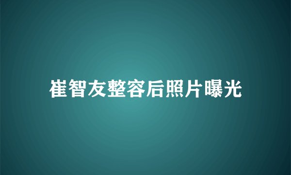 崔智友整容后照片曝光