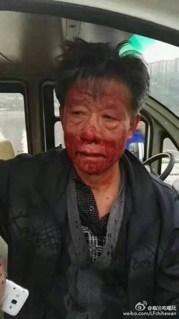 两女和狗围攻老人 被打老人满脸是血