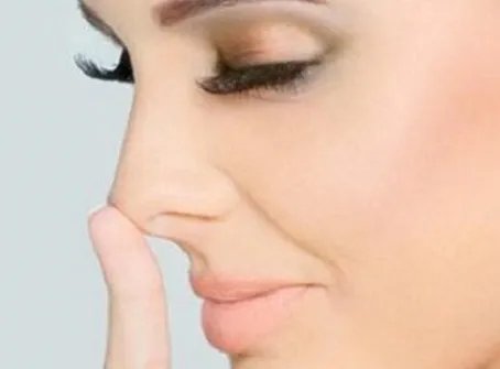 鹰钩鼻矫正有哪些方法