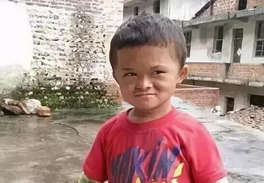 小马云被鉴定为二级智力残疾是怎么回事 二级智力残疾是什么概念