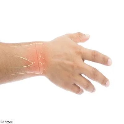 桡骨粉碎性骨折怎么办