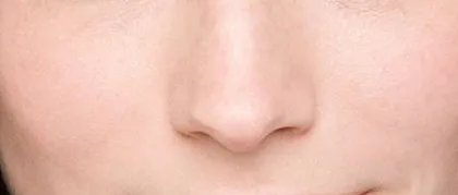 歪鼻矫正怎么做