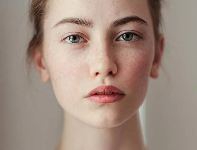 昆山激光祛斑费用